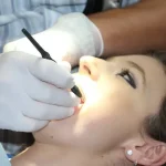 Rola fluoryzacji w ochronie zębów